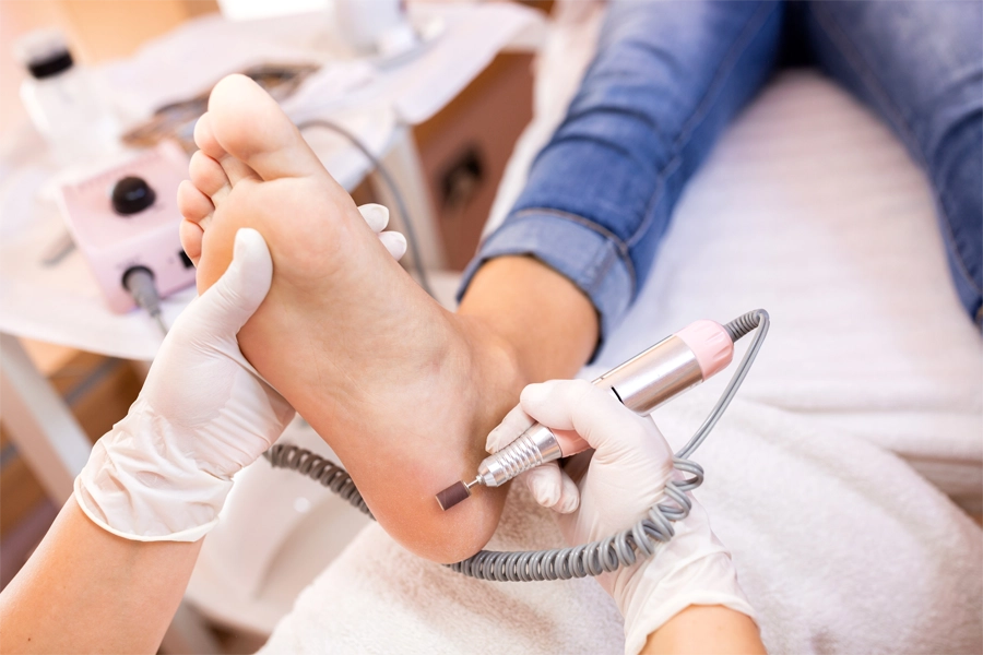 Cuidados preventivos com os pés